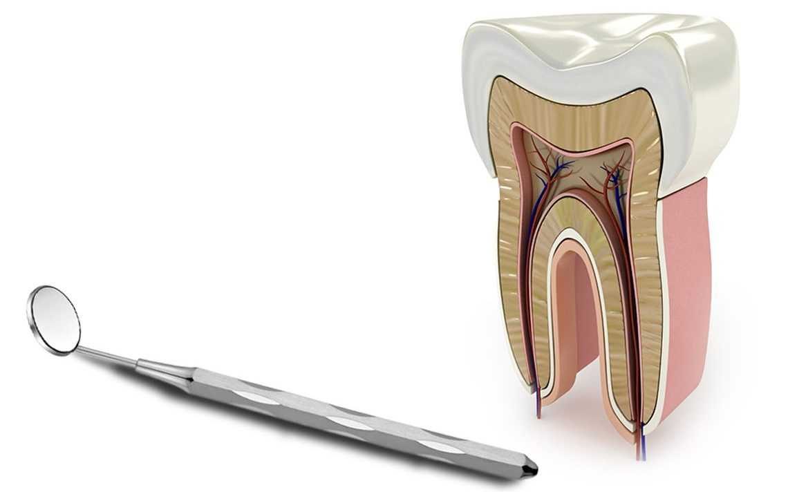 endodonti