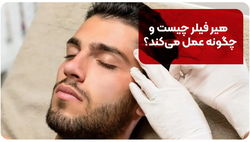 هیر فیلر چیست و چگونه عمل می&zwnj;کند؟