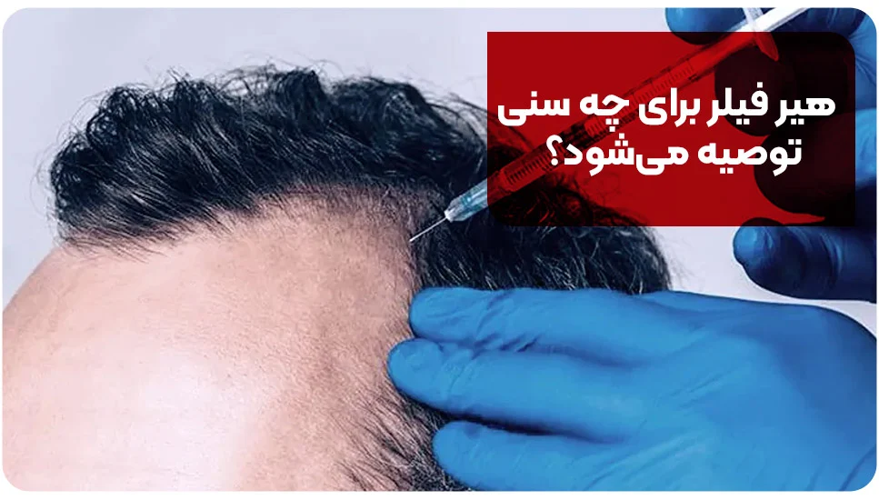 هیر فیلر برای چه سنی توصیه می&zwnj;شود؟
