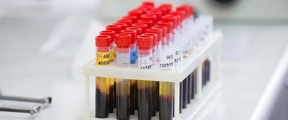 مقایسه قیمت خدمات آزمایشگاه حضوری و در منزل