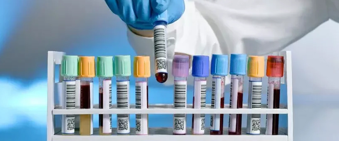 نکات مهم قبل و بعد از آزمایش خون