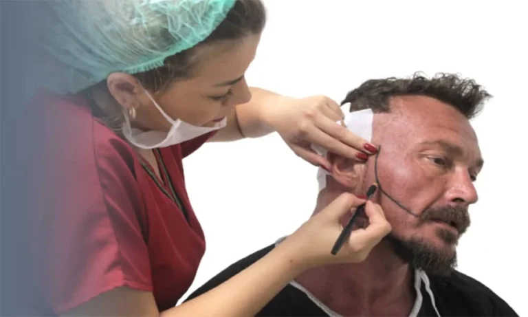 علت ریزش ریش و سبیل یا کم پشت بودن موهای صورت