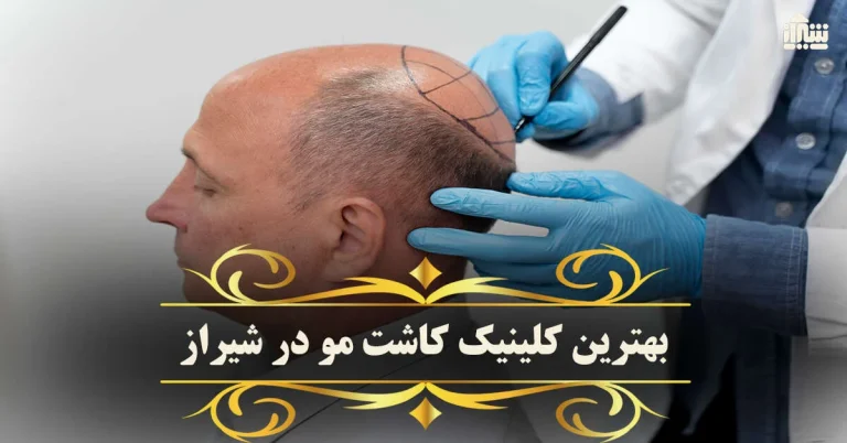 چگونه از سفید شدن زودرس مو جلوگیری کنیم؟ راهکارهای خانگی و تغذیه ای مؤثر