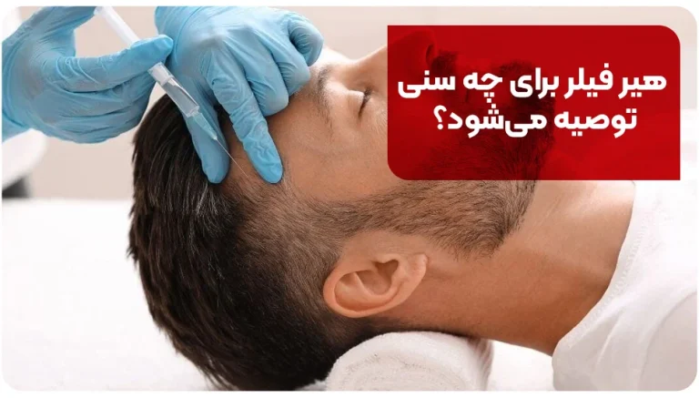 هیر فیلر برای چه سنی توصیه می شود؟