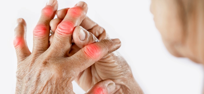 آرتریت روماتوئید؛ کشف زودهنگام از طریق خون پیش از بروز علائم